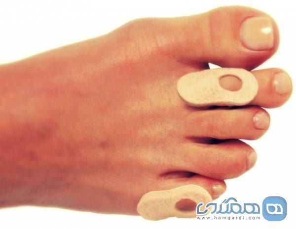 افرادی که نباید چسب میخچه استفاده کنند