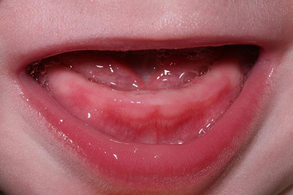دندان شیری چیست و چه وظایفی دارد؟ دندان شیری چیست و چه وظایفی دارد؟