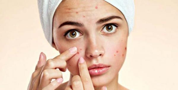 کرم ترتینوئین موثر در درمان آکنه های پوستی