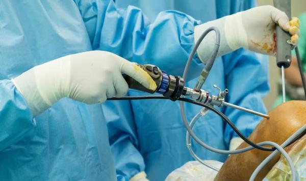 عمل آرتروسکوپی چیست و چه عوارضی دارد؟