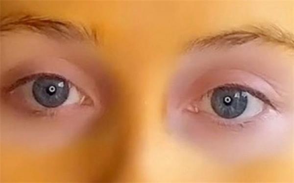 پشیمانی زن جوان در پی استفاده از ماسک زردچوبه!