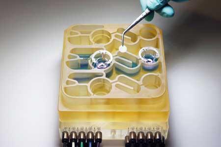 ارتباط باکتری های روده با بیماری های عصب شناختی