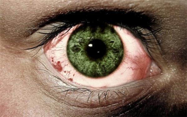 درباره نابینایی موقت یا از دست دادن کوتاه مدت دید چه می دانید؟