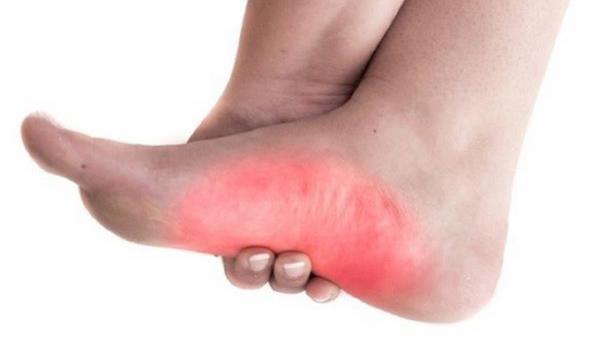 درمان های خانگی ساده، اما موثر در تسکین فوری پا درد