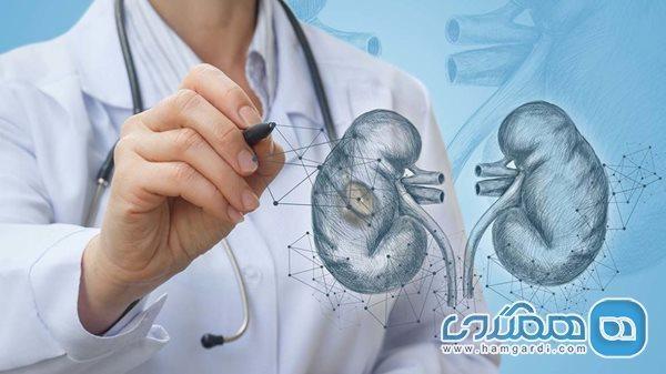 10 نکته جالب در مورد سنگ کلیه