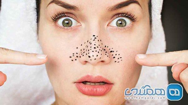 روشهایی برای ناپدید شدن دانه های سر سیاه روشهایی برای ناپدید شدن دانه های سر سیاه