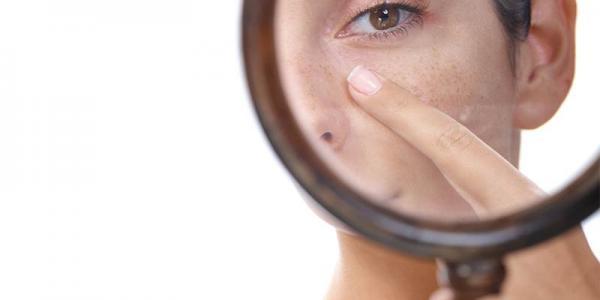 5 توصیه مهم برای بستن منافذ پوست