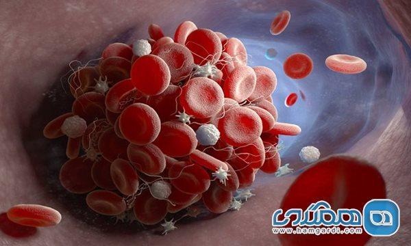 دانستنی هایی درباره ترومبوز سرخرگی