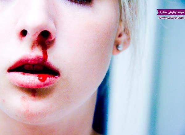 علت خون دماغ شدن چیست و چگونه درمان می گردد؟