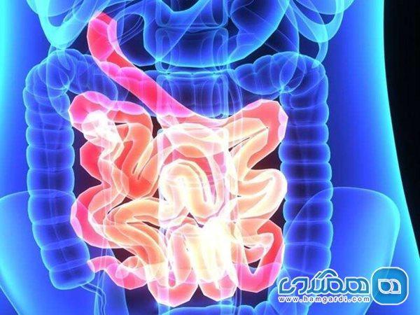راهکارهایی مفید برای بهبود سلامت روده