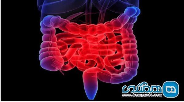افراد چاق و بی تحرک بیشتر مستعد ابتلا به سرطان روده هستند