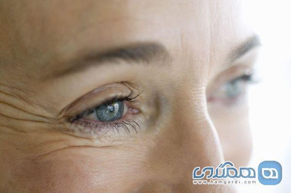 کم خوابی چطور باعث آکنه و چین و چروک می شود؟