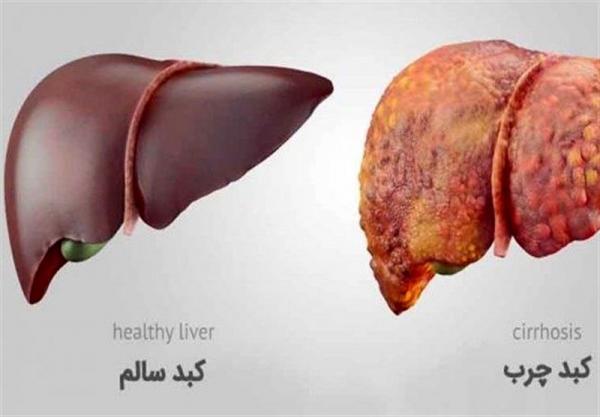 این نوشیدنی از ابتلا به کبد چرب پیشگیری می کند