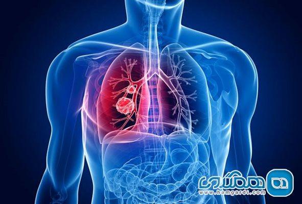 چطور ریه قوی داشته باشیم؟