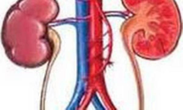 بی اختیاری ادرار استرسی