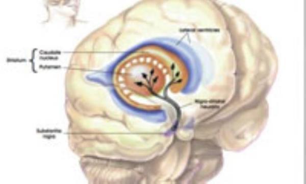 پارکینسون در یک نگاه پارکینسون در یک نگاه