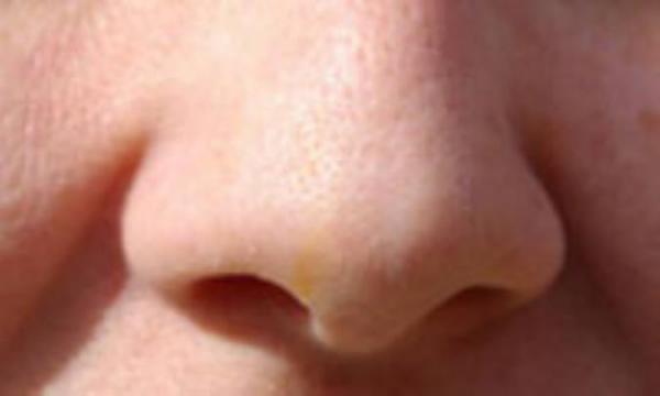 کاهش حس بویایی؛ علل و راه چاره