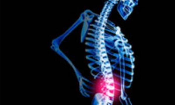 راه های جلوگیری از کمردرد