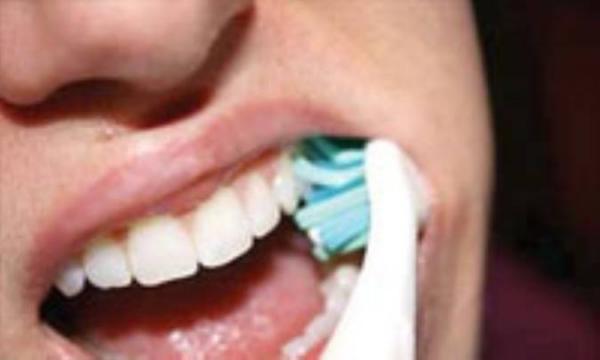 چطور دندان هایی سفید داشته باشیم؟