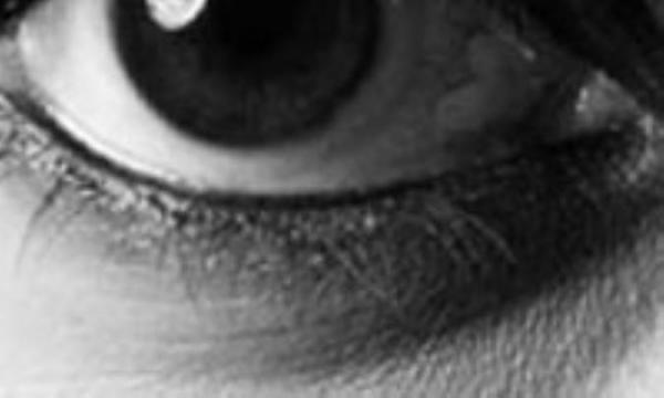 8 روش طلایی برای کاهش تیرگی زیر چشم 8 روش طلایی برای کاهش تیرگی زیر چشم