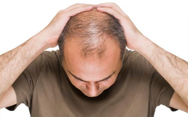 پیشگیری از ریزش موها با 7 خوراکی موثر