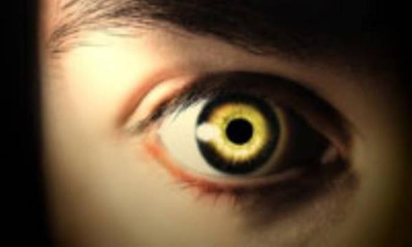 چشم، دریچه سلامت بدن!