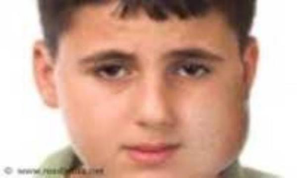 دلایل ورم کردن گونه دلایل ورم کردن گونه