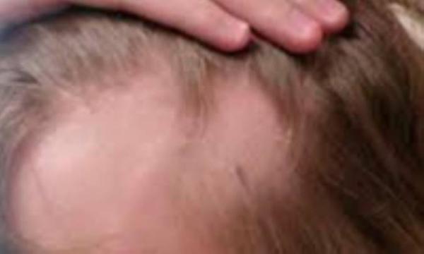 روش های خانگی برای ترمیم موهای نازک