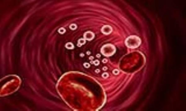 علل تعداد پایین پلاکت