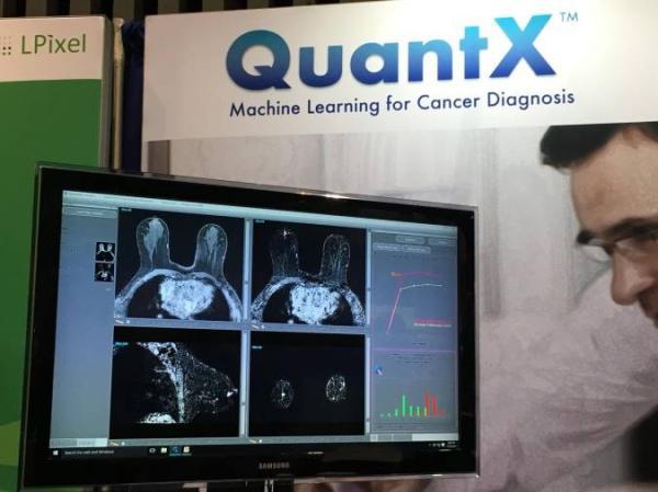 هوش مصنوعی می تواند تشخیص دقیق تری در خصوص سرطان پستان داشته باشد