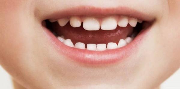 چگونه از دندان شیری بچه ها مراقبت کنیم؟ چگونه از دندان شیری بچه ها مراقبت کنیم؟