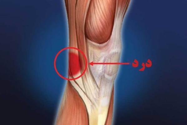 درد در قسمت های بالایی پا