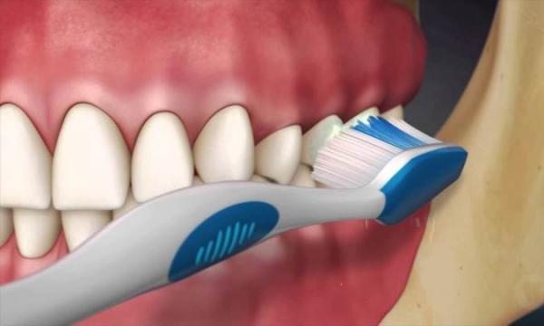 اصولی ترین روش مسواک زدن اصولی ترین روش مسواک زدن