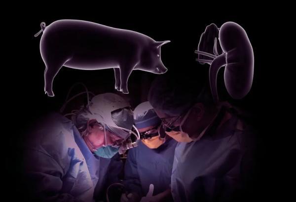 جراحان آمریکایی با موفقیت کلیه یک خوک را به یک بیمار پیوند زدند