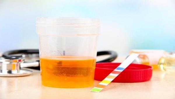 بررسی علل بدبو شدن ادرار و درمان خانگی آن آنالیز علل بدبو شدن ادرار و درمان خانگی آن