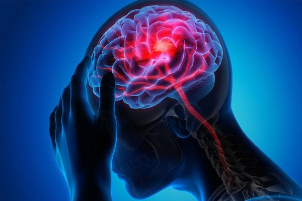 این ها نشانه سکته مغزی هستند!