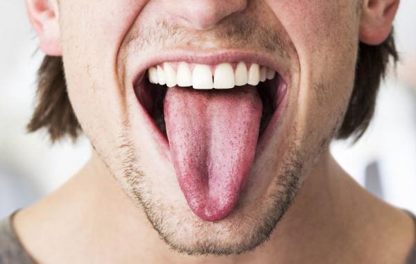 15 ماده ی طبیعی فوق العاده برای درمان برفک دهان